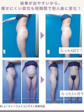 ピカイチ 上通店(pikAicHi)/サーモシェイプボディ