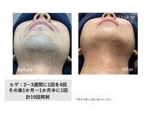 ディーエムピーコネクト(dmp connect)の雰囲気（脱毛で青髭解消できます！）