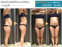 アイスタイル(i-style)