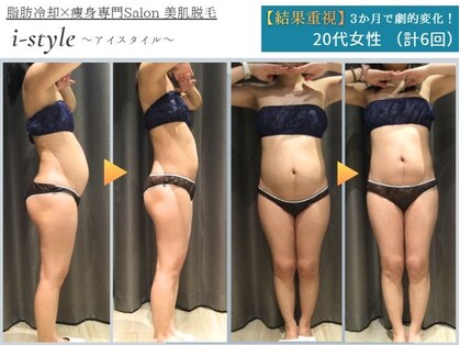 アイスタイル(i-style)の写真