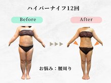 美容整体 ウェリナ 蟹江院/小顔矯正/骨盤矯正/美脚サロン 