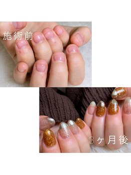 スマイル ネイル ラボラトリー(Smile nail laboratory)の写真/“結果重視の本格ケア”で地爪の健康を保ちながら指先を美しく♪ボロボロになったお爪も健康的な美爪に…☆