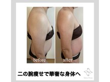 サロンフロム つくば店(Salon From)/◆二の腕セルゼロ痩身◆