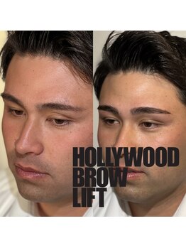 ハービー 高岳店(HARVEY)/お客様施術例