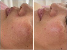 エムズビューティーラウンジ(M's Beauty Lounge)の雰囲気（お肌に透明感を与えてハリツヤUP♪エステ/フェイシャル/美白）