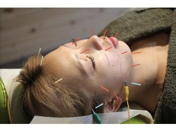 鍼灸治療院 森空堂 本院/美容鍼灸もおまかせ！