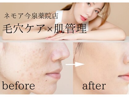 ネモア 今泉 薬院店の写真