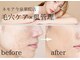 ネモア 今泉 薬院店の写真