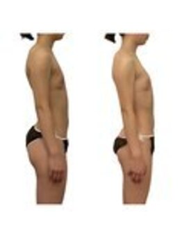 ベンザイ 新潟店(BENZAI)/首の後ろに脂肪乗ってませんか？