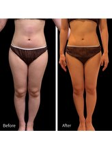 クールヴィラ(Cool Villa)/