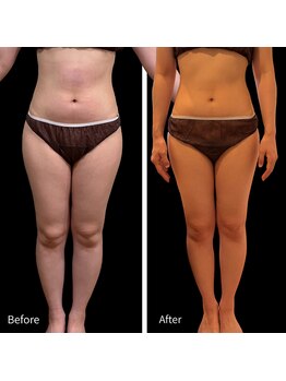 クールヴィラ(Cool Villa)/