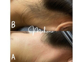 マハナ(mahana)/うなじWAX お好みの形に