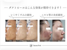 アンベリール(embellir)の雰囲気（最新ダクトピーリングでお肌トラブルさよなら4月限定¥10,000）