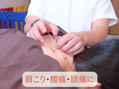 やくわ新坂町はり灸マッサージ治療院の写真