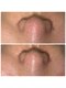 サラン スキンサロン(Sarang skin salon)の写真/【黒ずみ・いちご鼻卒業】プロの毛穴洗浄で頑固な汚れをすっきりオフ！触りたくなるツルツル素肌へ♪
