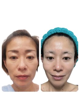 そら/小顔/ヘッドマッサージ