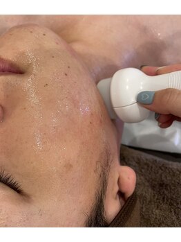 ミスト(MISTO)/メンズフェイシャルエステ☆