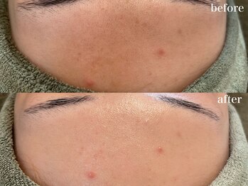 リボーン 浜松(reborn)/