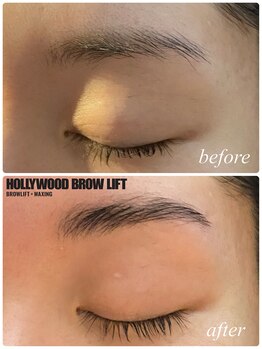 マノ ア マノ(Mano A Mano)/ハリウッドブロウリフト