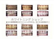 ホワイトニングショップ せんげん台店