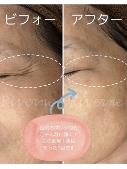 リヴェーヌ 呉羽店(Riverne)/