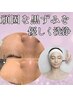 【毛穴洗浄】乳酸マスクピーリング+超音波洗浄で黒ずみ撃退！！