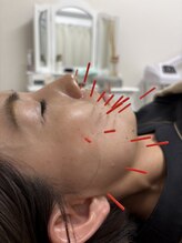 サロン ド グランツィア(salon de Granzia)/40代女性☆顔全体のたるみ悩み