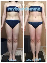 ラヴィソンファム(Ravissant femme)/ハイパーナイフシェイプ全身痩身