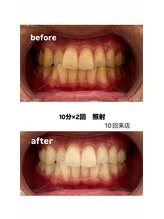 エム(M)/１０回症例写真