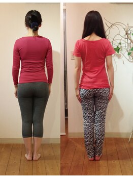 松山美容整体院/（３０歳代）施術例