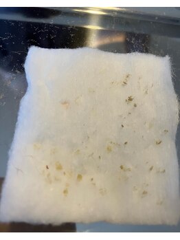 リンカ(Rinca)/すごっ！！毛穴の角栓とれた！