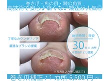 巻き爪補正店 秋葉原店