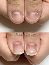 マリーロール 淀屋橋本店(Marie Laure)/自爪育成/深爪矯正/ネイルケア