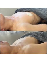 モア(moa)/バストケア