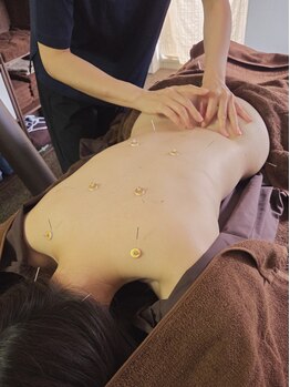 スゴ腕の施術者がいるサロン