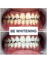 ビーホワイト 名古屋金山店(BE WHITE)/あなたも短期間で理想の白い歯に