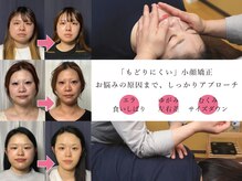 美容整体 アルマ