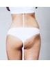 【全身痩せ&すっきり小顔】劇的変身全身応援120分コース¥9000→¥7200