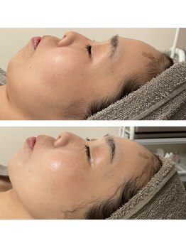 パールムーン(pearl moon)/エイジングハーブ　3g