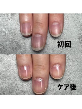 甘皮ケアで整う指先