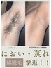 【メンズ脱毛★スッキリ快適！】☆特別価格☆最新SHR ☆ヒゲ脱毛＋ワキ脱毛☆