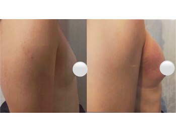 ビルーチェ(BELUCE)/サイズアップ結果出し育乳バスト