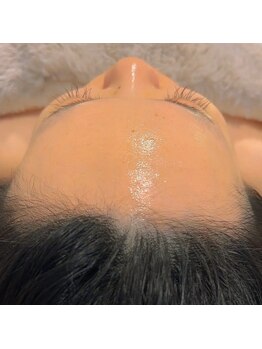 ラリリー(La Lily)/つや肌 ミコステラ