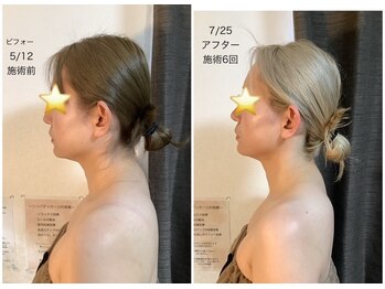 イーリス(i-ris)/ブライダルエステもお任せ◎