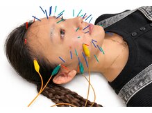 ハートテラス整骨院 鍼灸院の雰囲気（美容鍼）