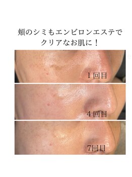 ユヌランコント 岐阜店(Une rencontre)/エンビロン