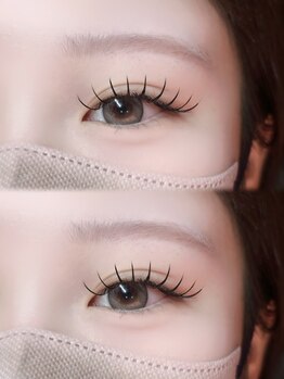 ミイプ(MEPP)/つねいし担当・フラットラッシュ