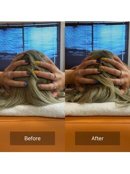 カラダプラス(kArAdA+)/頭蓋骨矯正ビフォーアフター女性