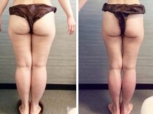 ウェリナ平和堂長久手院/小顔矯正/骨盤矯正/痩身/整体