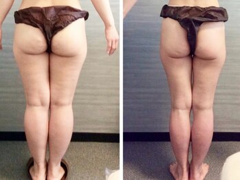 ウェリナ平和堂長久手院/小顔矯正/骨盤矯正/痩身/整体